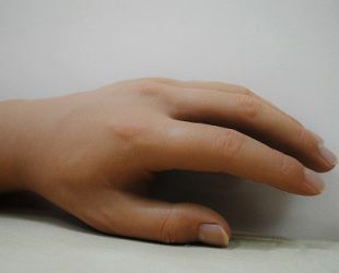 Proteza dłoni